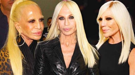 fortuna de donatella versace|donatella versace face what happened.